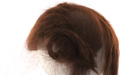 Adaptive Nonlinearity for Collisions in Complex Rod Assemblies