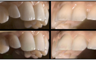 Appearance Capture and Modeling of Human Teeth
