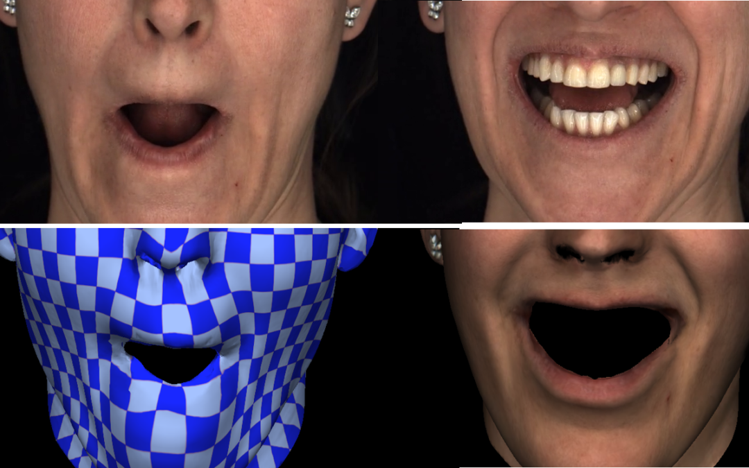 Corrective 3D Reconstruction of Lips from Monocular Video